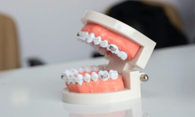 Metal vs Ceramic Braces