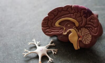 Symptoms of Alzheimer