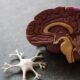 Symptoms of Alzheimer
