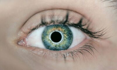 LASIK Eye Surgery