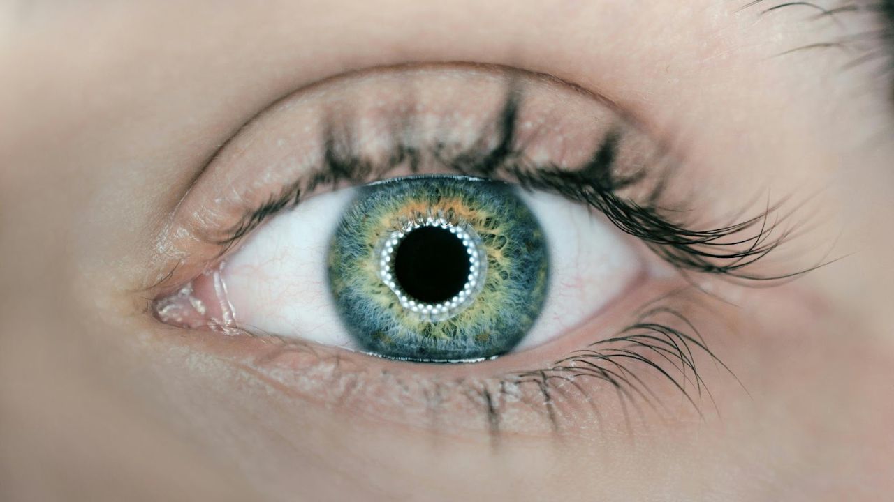 LASIK Eye Surgery